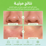 ⁦رول مبرد بخلاصة الصبار لتهدئة البشرة⁩ - الصورة ⁦3⁩