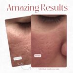 ⁦رول مبرد بخلاصة الصبار لتهدئة البشرة⁩ - الصورة ⁦5⁩